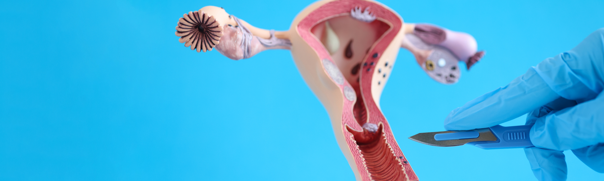 جراحة اورام أمراض النساء